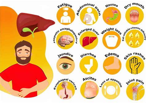 bile leakage symptoms|Primary biliary cholangitis